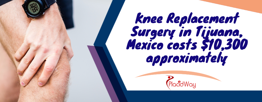 Knee Replacement Cost in Tijuana, Mexico